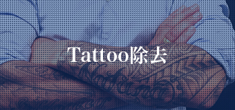 Tattoo除去