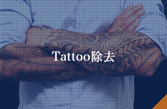 Tattoo除去